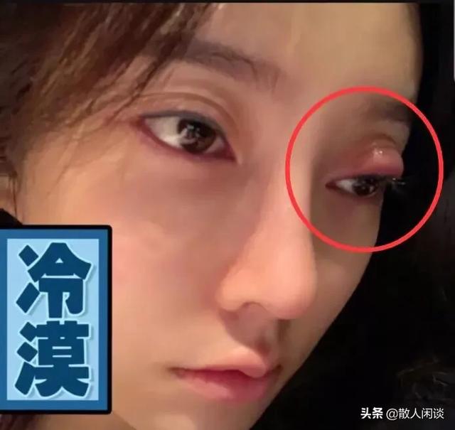 斗鱼一姐<a href='http://www.mcnjigou.com/?tags=35
' target='_blank'>冯提莫</a>患上怪病，双眼险些毁容，求助粉丝偏方治病，粉丝这下真慌了，你怎么看？  <a href='http://www.mcnjigou.com/?tags=35
' target='_blank'>冯提莫</a> 第2张