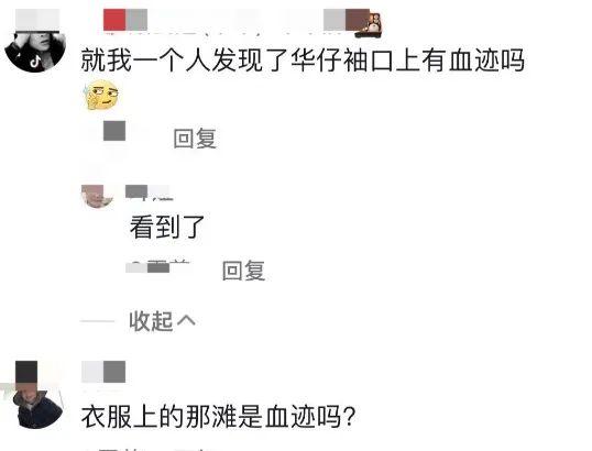 61岁刘德华拍视频秀厨艺，右手臂现出红色血迹，身体状况令人担心  刘德华 第9张